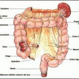 colitis ulcerosa 2